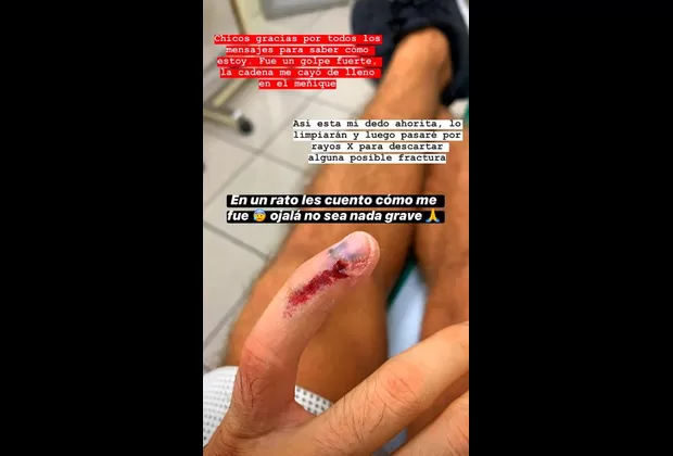 Patricio Parodi: ¿Cómo se encuentra el guerrero tras la lesión que sufrió en EEG?