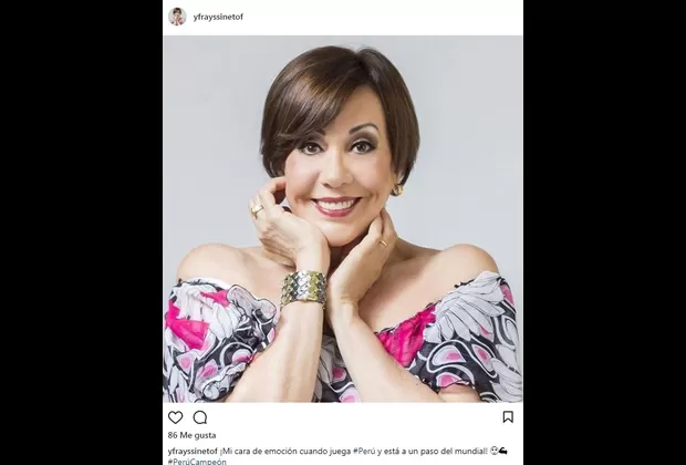 Artistas alientan así antes del Perú - Nueva Zelanda