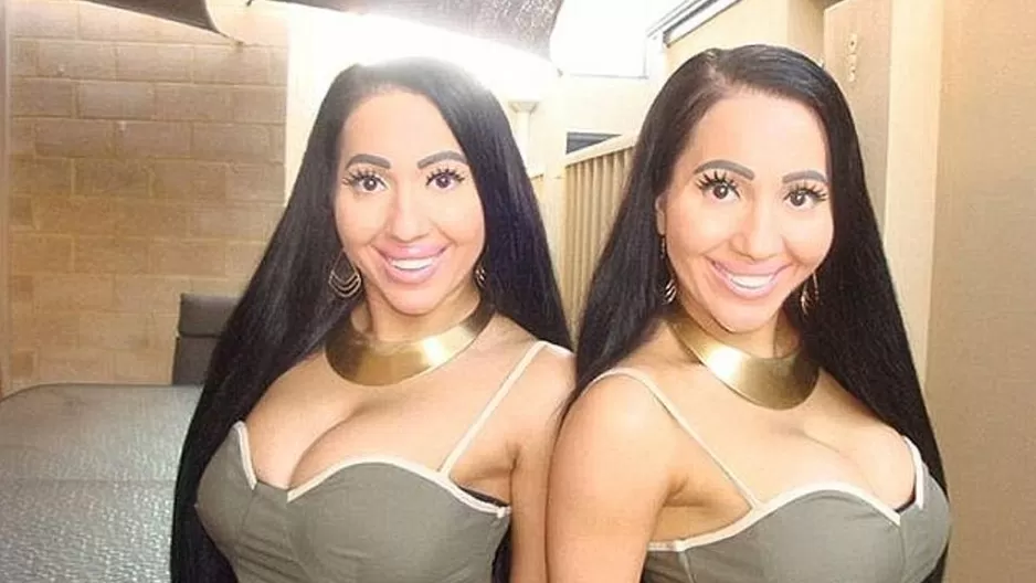 Anna y Lucy DeCinque, las gemelas obsesionadas por ser idénticas en todo. (Via: Daily Mail) Anna y Lucy DeCinque, las gemelas obsesionadas por ser idénticas en todo. (Via: Daily Mail)