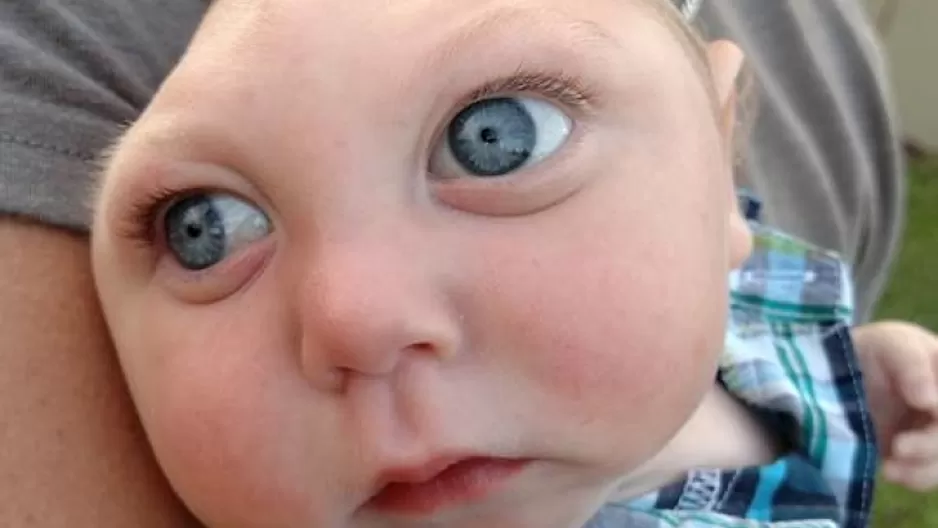 Facebook: Jaxon ‘Strong’, el niño que nació sin parte de su cerebro conmueve a miles