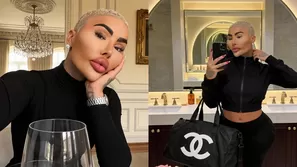 Fallece influencer ‘Rey de los labios’ a los 34 años / Instagram