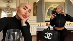 Fallece influencer ‘Rey de los labios’ a los 34 años / Instagram