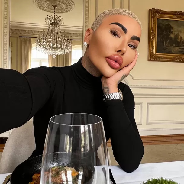 Jordan James Parke participó dos veces en el polémico programa ‘Botched’ para retocarse sus labios y someterse a una liposucción / Instagram Jordan James Parke participó dos veces en el polémico programa ‘Botched’ para retocarse sus labios y someterse a una liposucción / Instagram