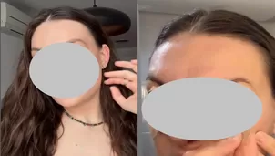 Influencer se opera la nariz y muestra “gran decepción” / Instagram