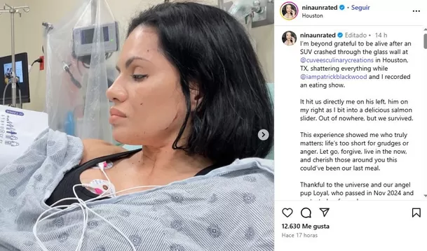 La influencer Nina Santiago mostró detalles de las heridas que le dejó el duro accidente / Instagram