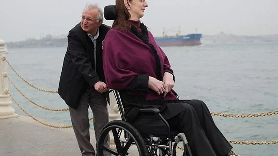 Rumeysa Gelgi sufre de síndrome de Weaver. (Vía: Twitter) Rumeysa Gelgi sufre de síndrome de Weaver. (Vía: Twitter)