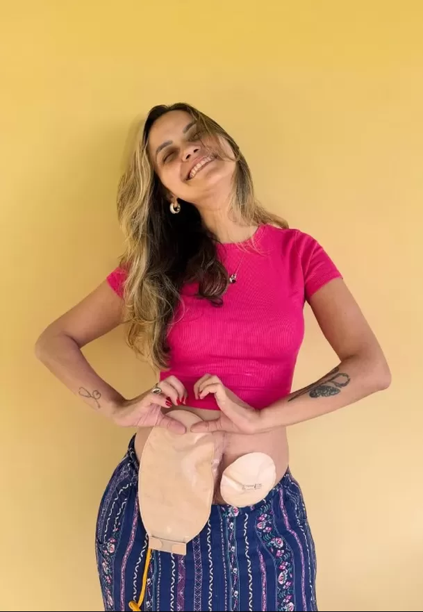 Partió joven influencer brasileña tras tres años de lucha contra el cáncer/ Instagram