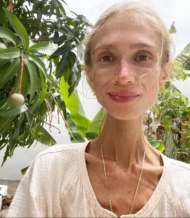 Karolina Krzyżak murió pesando apenas 22 kilos / Instagram