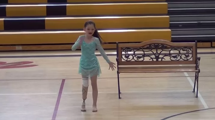YouTube: emotivas imágenes muestran a una niña bailando tras amputación de pierna YouTube: emotivas imágenes muestran a una niña bailando tras amputación de pierna