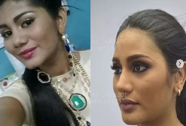Miss Venezuela: revelan sus fotografías antes de someterse a cirugías plásticas
