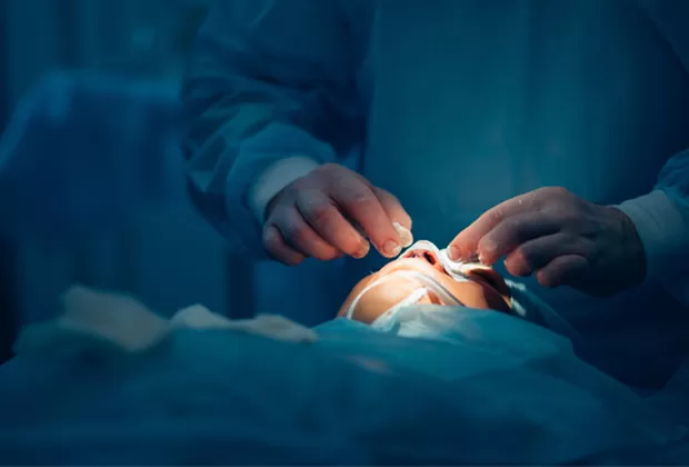 Lo que debes saber antes de una rinoplastia 