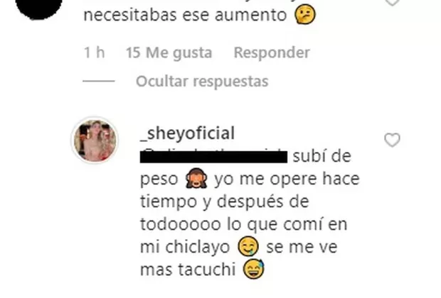 Sheyla Rojas da contundente respuesta tras cuestionamientos por supuesta cirugía plástica