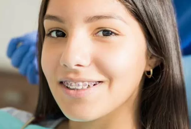 los dientes pueden moverse luego de usar brackets