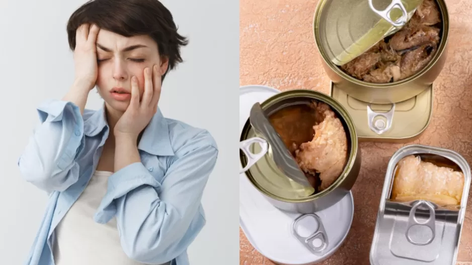 Conoce los síntomas de ingerir la bacteria de un producto enlatado en mal estado. Conoce los síntomas de ingerir la bacteria de un producto enlatado en mal estado.