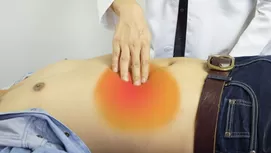 Apendicitis: ¿A qué lado duele y cuáles son los síntomas?