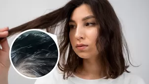 El tipo de shampoo que debes usar si tienes el cabello muy graso.