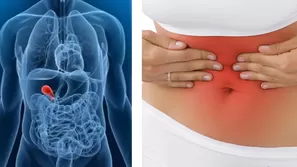 Síntomas de la cálculos en la vesícula biliar