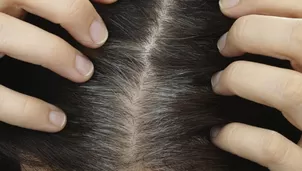 Remedios naturales para combatir las canas