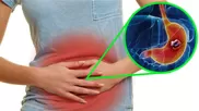 Síntomas de cáncer de estomago que debes conocer
