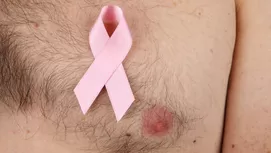 Los síntomas del cáncer de mama en mujeres y hombres