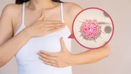 ¿Por qué debes preocuparte si detectas un bulto en las axilas?