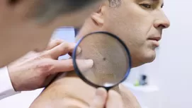 Seis consejos para cuidar tu piel este verano