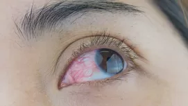 ¿Por qué me tiembla el ojo y cuándo es urgente ir al médico?