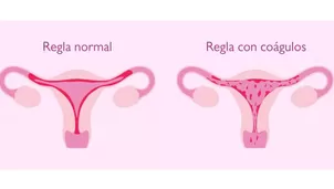 Descubre por qué salen coágulos de sangre en la menstruación