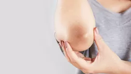 ¿Por qué te salen moretones en el cuerpo sin golpearte?