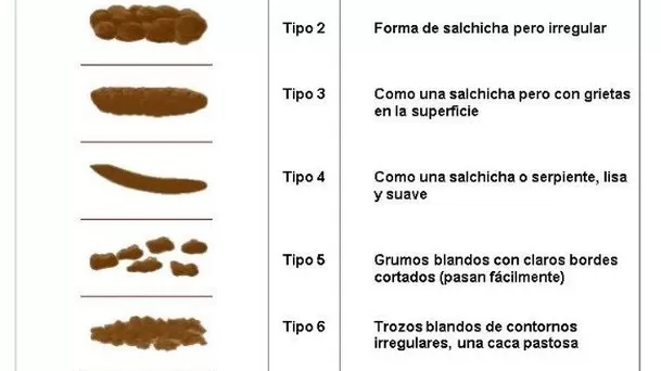 Significado de la forma de las heces. (Foto: Bristol Royal Infirmary)