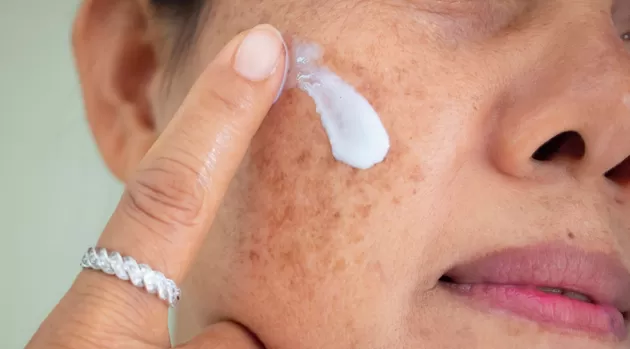 Qué productos sí pueden borrar las manchas del rostro
