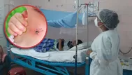 ¿Cómo curar el dengue en casa?