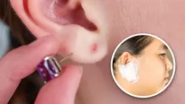 Sigue estas recomendaciones si tienes una oreja infectada por un arete. 