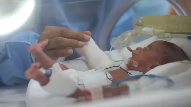 Controles prenatales periódicos desde las 6 a 7 semanas ayudan a identificar riesgos de un nacimiento prematuro. (Foto: Andina)
