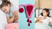 ¿Cuándo hay que preocuparse por una menstrución anormal en niñas y adolescentes?
