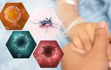 Síntomas del dengue que se pueden confundir con la COVID-19 - Noticias de ministro-salud