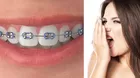 ¿Cómo eliminar el mal aliento si estás usando brackets?