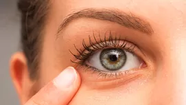 ¿Por qué te salen ojeras y cómo puedes quitarlas?