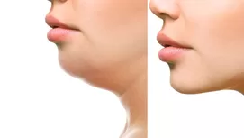 Adiós a los cachetes y papada: tips para adelgazar la cara