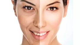 Alimentos naturales que contienen colágeno, para una piel más bonita