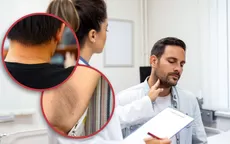 Manchas oscuras en el cuello: ¿Cómo quitarlas y qué enfermedad lo causa? - Noticias de la-bachata