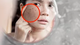 Elimina las manchas de tu rostro con estos exfoliantes naturales