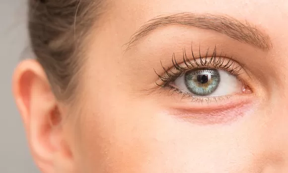 Tres tipos de ojeras y cómo debes tratarlas para ver resultados - America  Noticias