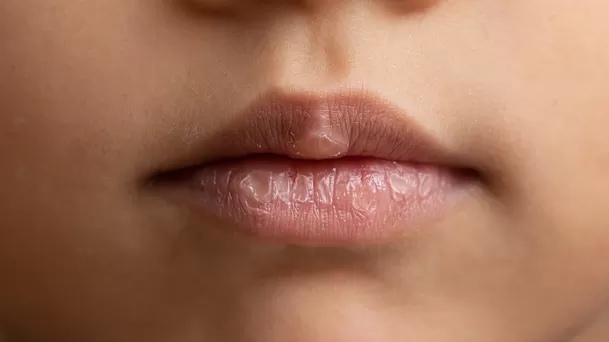 ¿Por qué tengo los labios secos y agrietados?