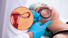 ¿Tienes vellos en la espalda? Razones por las que debes preocuparte