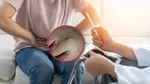 ¿Qué tipos de hernias abdominales existen?