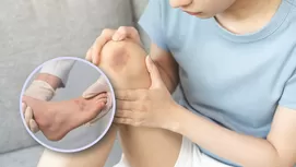 Bulto en la pierna u otra extremidad: ¿Cómo saber si es síntoma de cáncer?