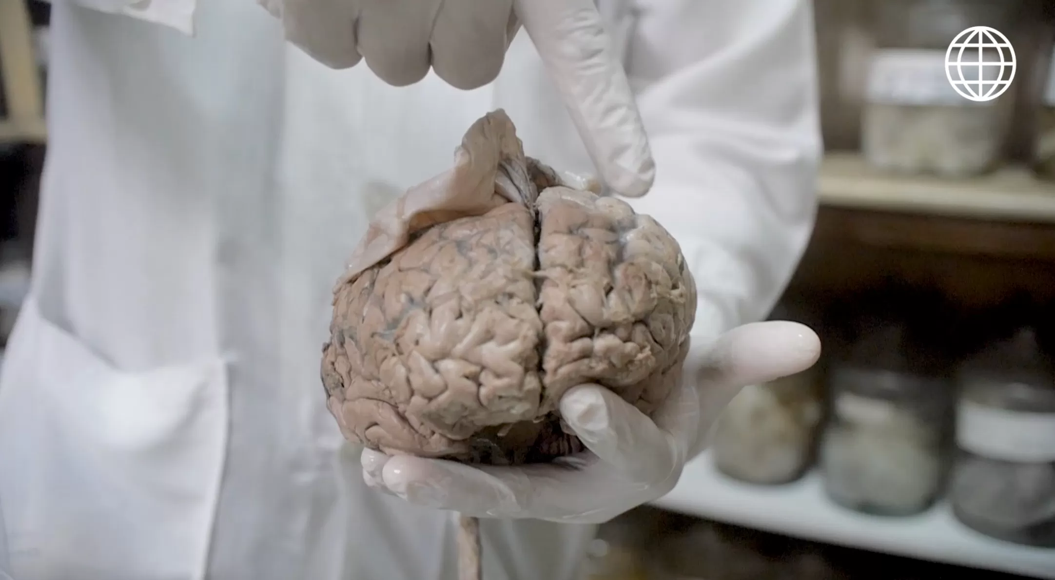 Lic. Prado señala la materia gris del cerebro. (Foto: Útil e Interesante)