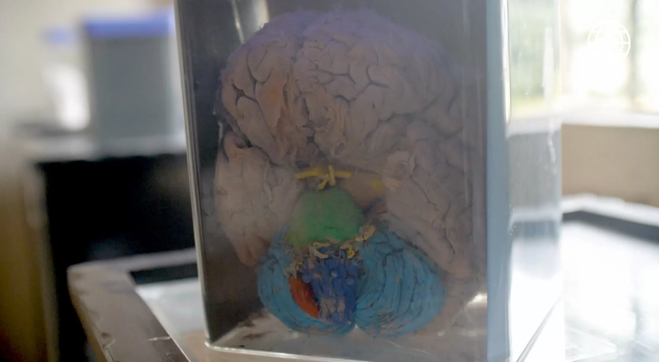 Base del cerebro, donde se muestra en rojo la amígdala cerebral. (Foto: Útil e Interesante)