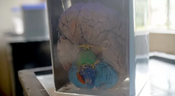 Base del cerebro, donde se muestra en rojo la amígdala cerebral. (Foto: Útil e Interesante)